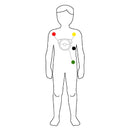 D-Heart - ECG portable 8/12 dérivations